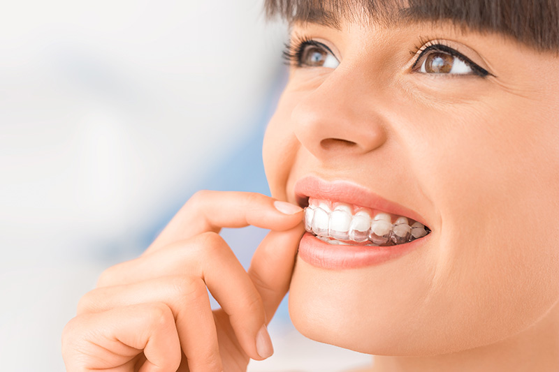 Invisalign in Mesa