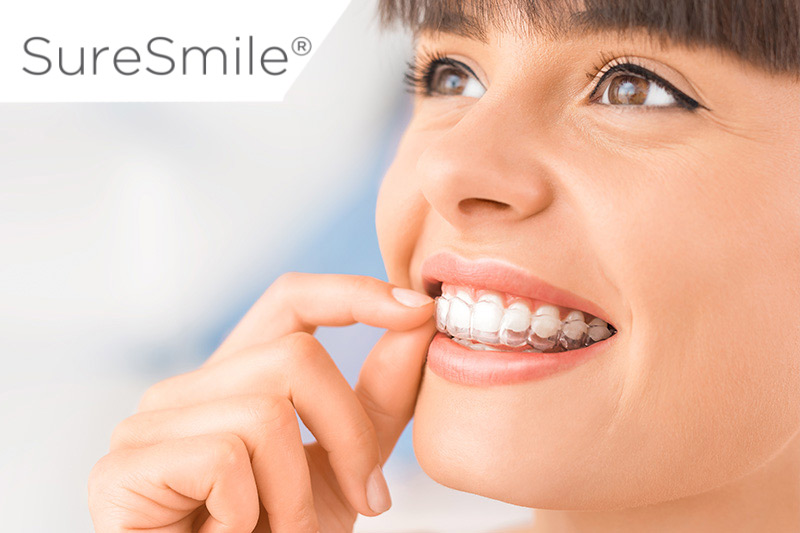 SureSmiles Clear Aligners in Mesa